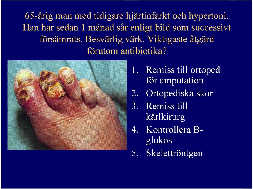 Besvärlig värk. Viktigaste åtgärd förutom antibiotika? 1.