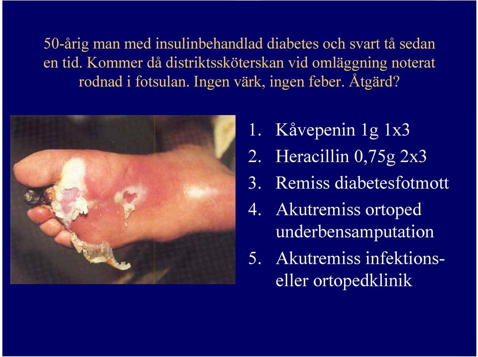 Ingen värk, ingen feber. Åtgärd? 1. Kåvepenin 1g 1x3 2. Heracillin 0,75g 2x3 3.