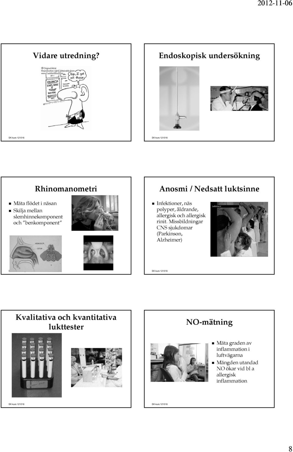 benkomponent Anosmi / Nedsatt luktsinne Infektioner, näs polyper, åldrande, allergisk och allergisk rinit.