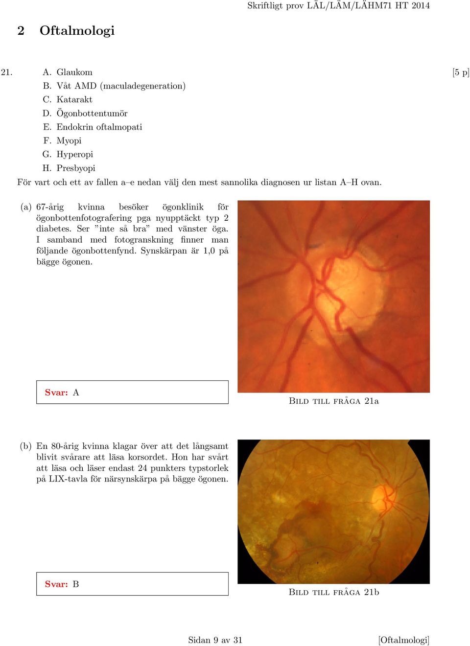 (a) 67-årig kvinna besöker ögonklinik för ögonbottenfotografering pga nyupptäckt typ 2 diabetes. Ser inte så bra med vänster öga.