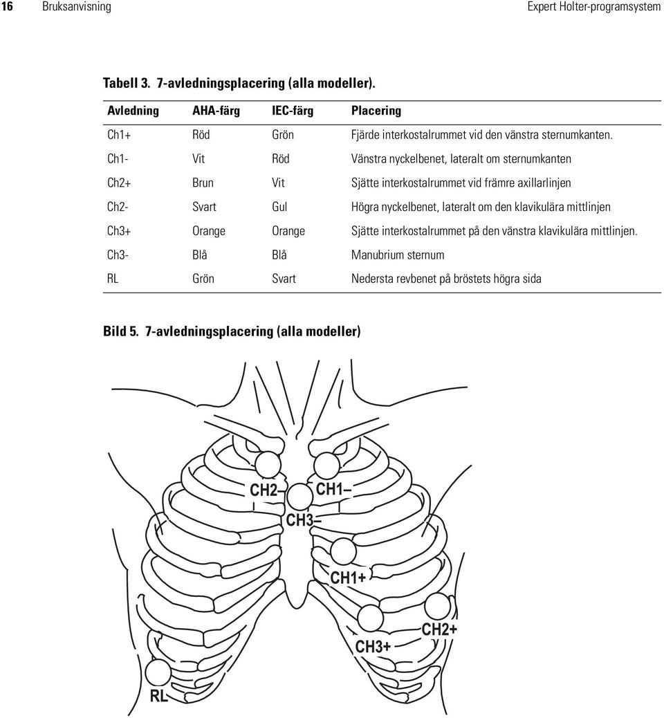 Ch1- Vit Röd Vänstra nyckelbenet, lateralt om sternumkanten Ch2+ Brun Vit Sjätte interkostalrummet vid främre axillarlinjen Ch2- Svart Gul Högra