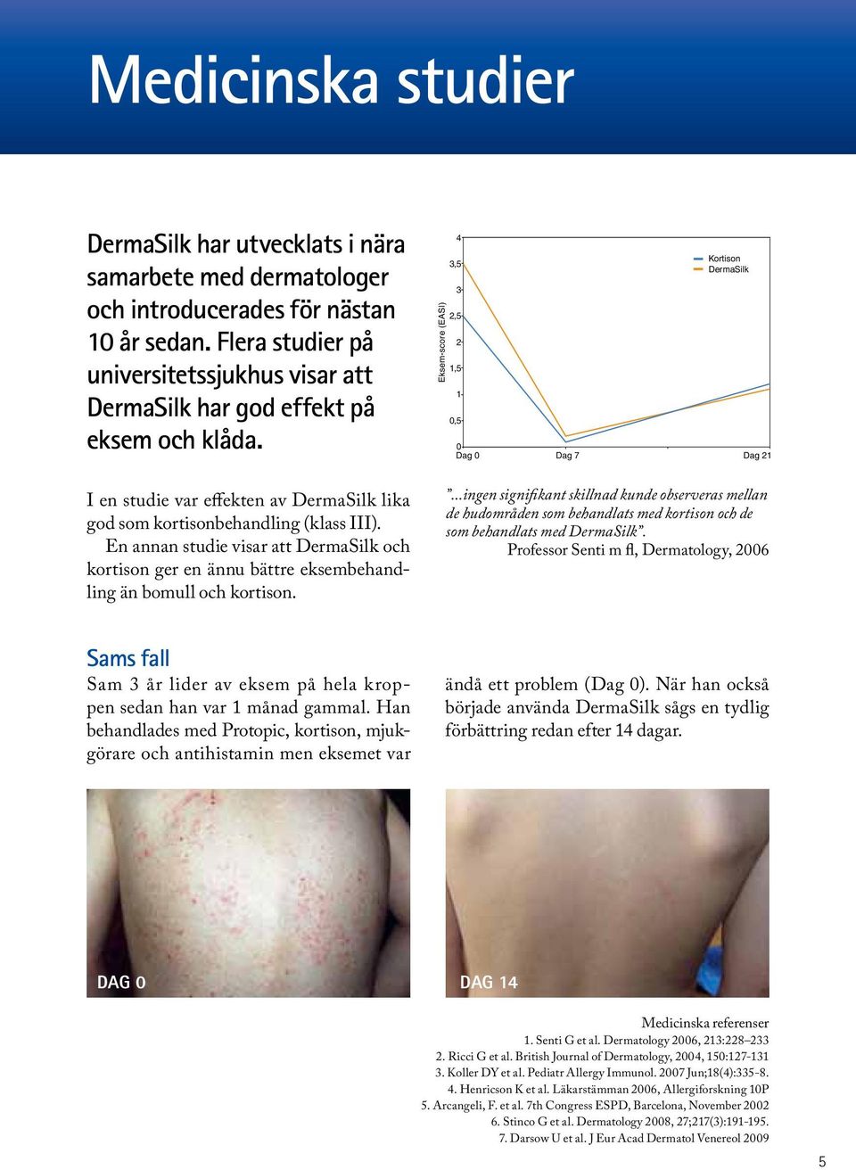 En annan studie visar att DermaSilk och kortison ger en ännu bättre eksembehandling än bomull och kortison. Eksem-score (EASI) 4 3,5 3 2,5 2 1,5 1 0,5 Kortison DermaSilk 0 Dag 0 Dag 7 Dag 21.