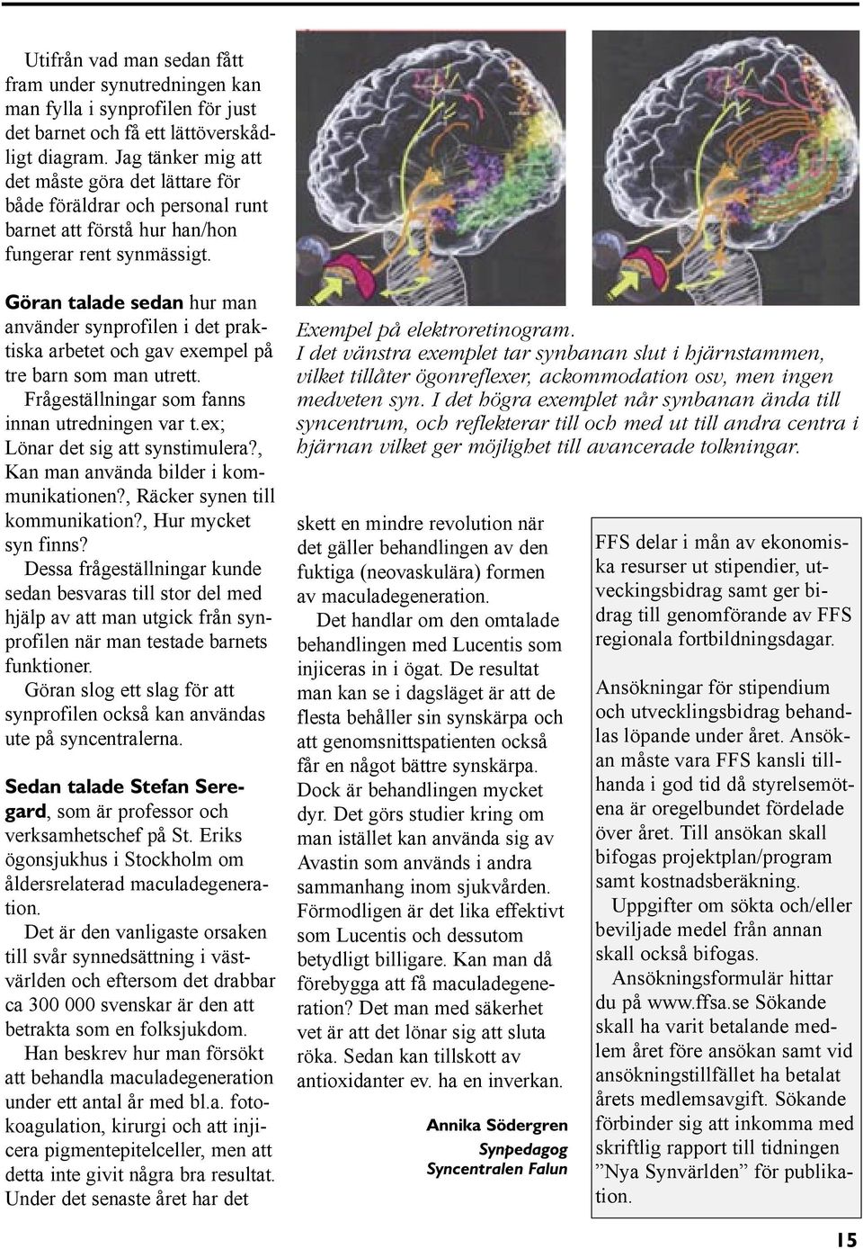 Göran talade sedan hur man använder synprofilen i det praktiska arbetet och gav exempel på tre barn som man utrett. Frågeställningar som fanns innan utredningen var t.