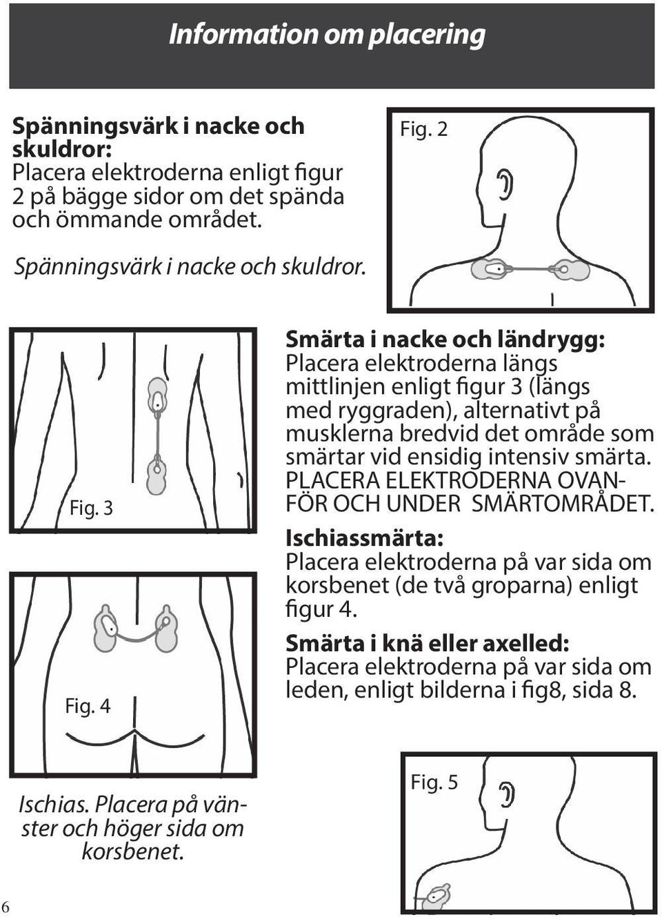 4 Smärta i nacke och ländrygg: Placera elektroderna längs mittlinjen enligt figur 3 (längs med ryggraden), alternativt på musklerna bredvid det område som smärtar vid ensidig