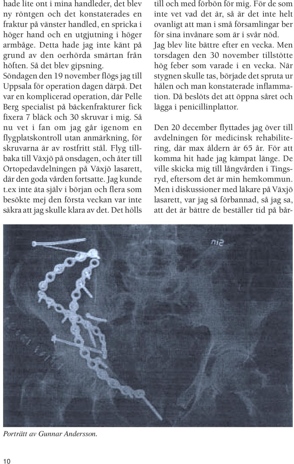 Det var en komplicerad operation, där Pelle Berg specialist på bäckenfrakturer fick fixera 7 bläck och 30 skruvar i mig.