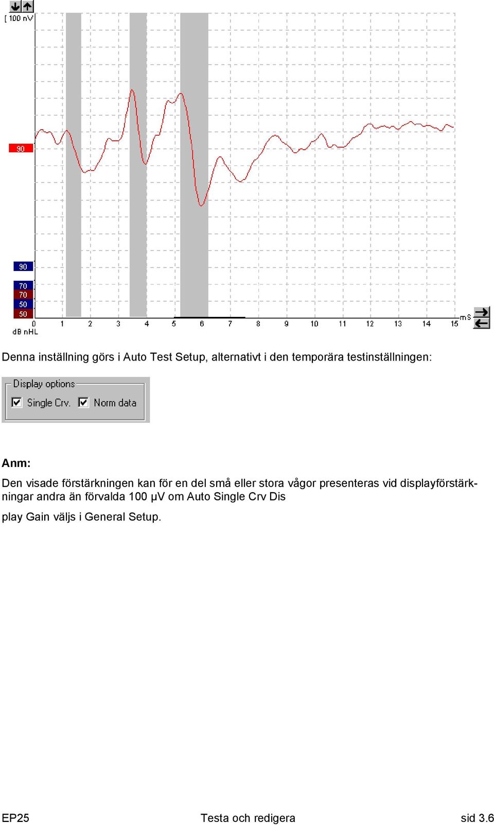stora vågor presenteras vid displayförstärkningar andra än förvalda 100 µv