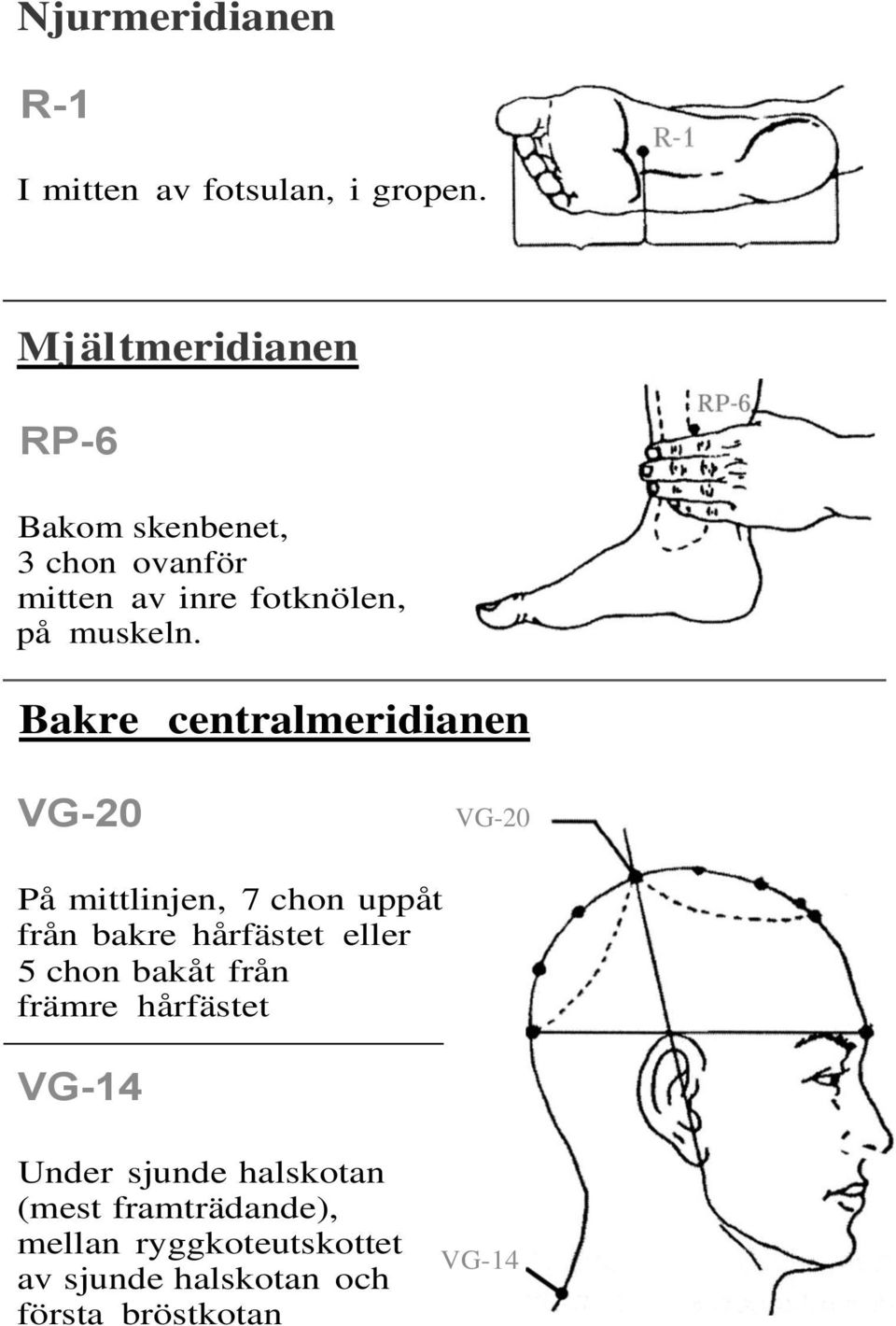 Bakre centralmeridianen VG-20 VG-20 På mittlinjen, 7 chon uppåt från bakre hårfästet eller 5 chon