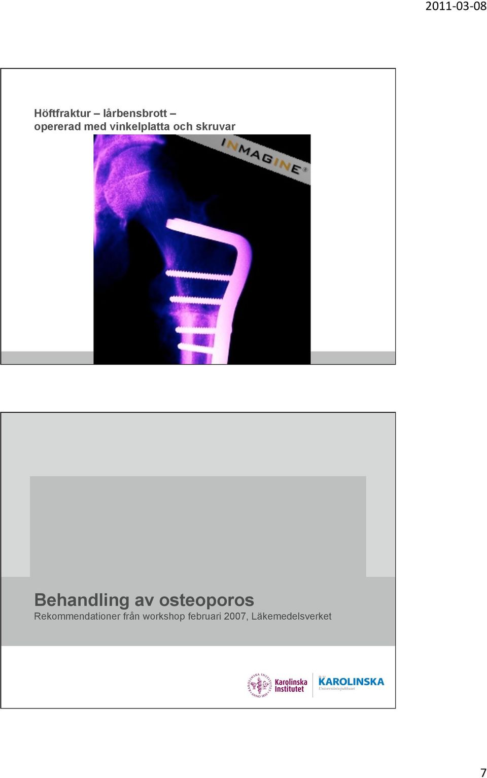 av osteoporos Rekommendationer från