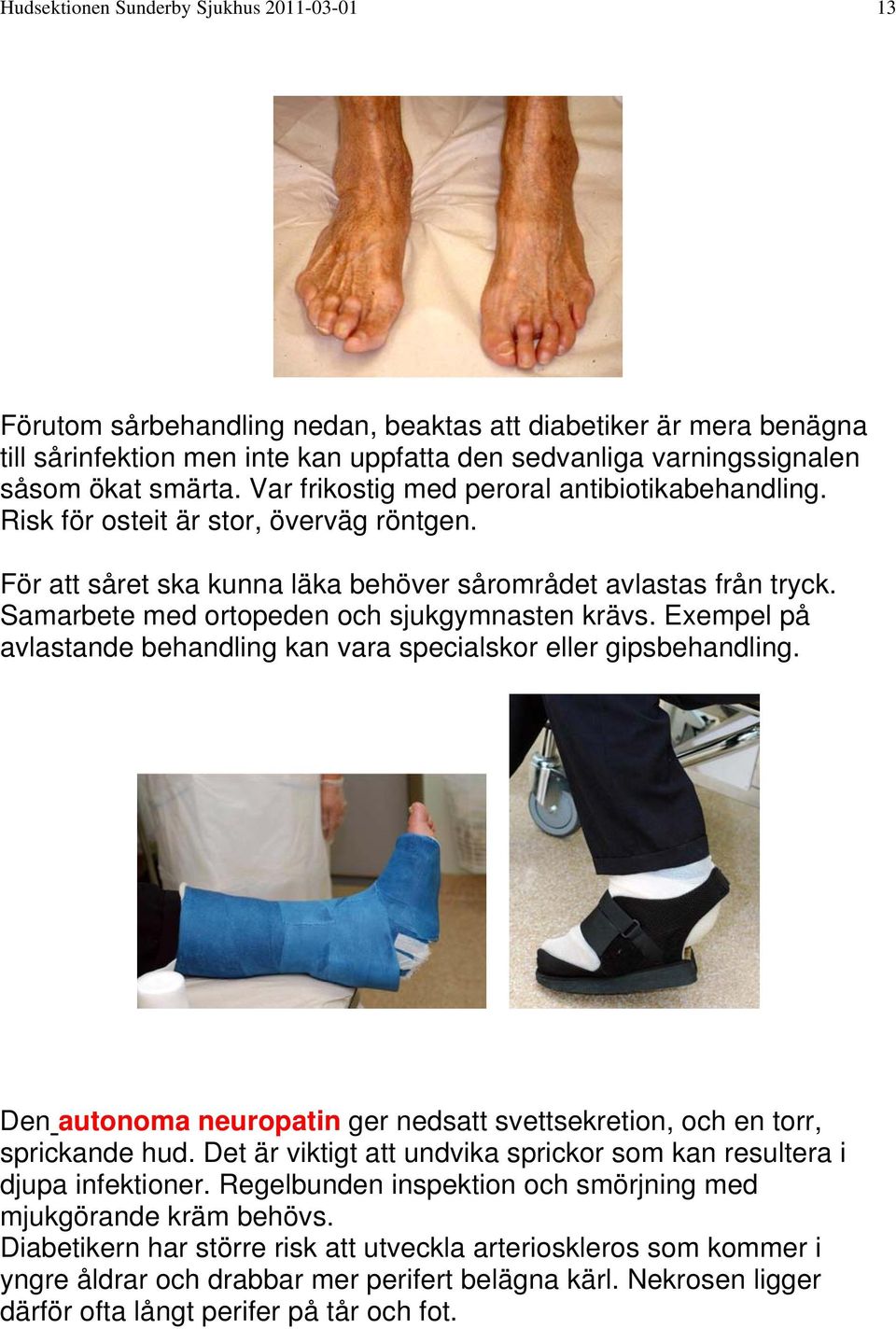 Samarbete med ortopeden och sjukgymnasten krävs. Exempel på avlastande behandling kan vara specialskor eller gipsbehandling.