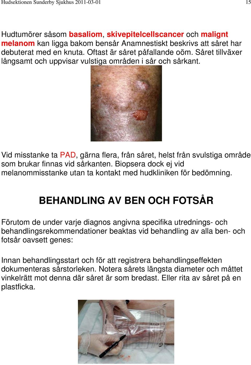 Vid misstanke ta PAD, gärna flera, från såret, helst från svulstiga område som brukar finnas vid sårkanten. Biopsera dock ej vid melanommisstanke utan ta kontakt med hudkliniken för bedömning.