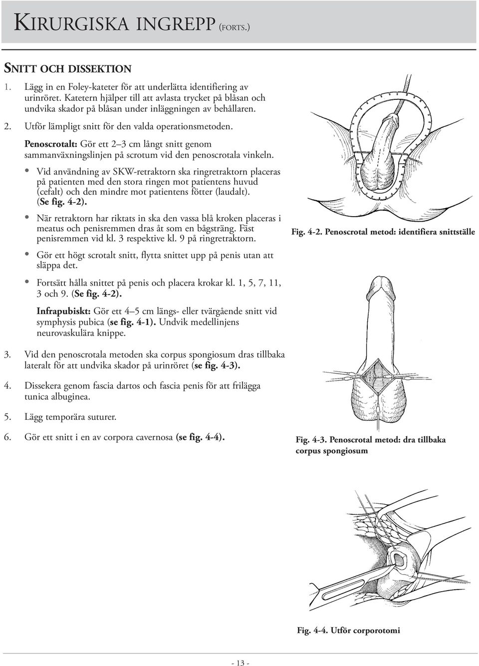 Penoscrotalt: Gör ett 2 3 cm långt snitt genom sammanväxningslinjen på scrotum vid den penoscrotala vinkeln.