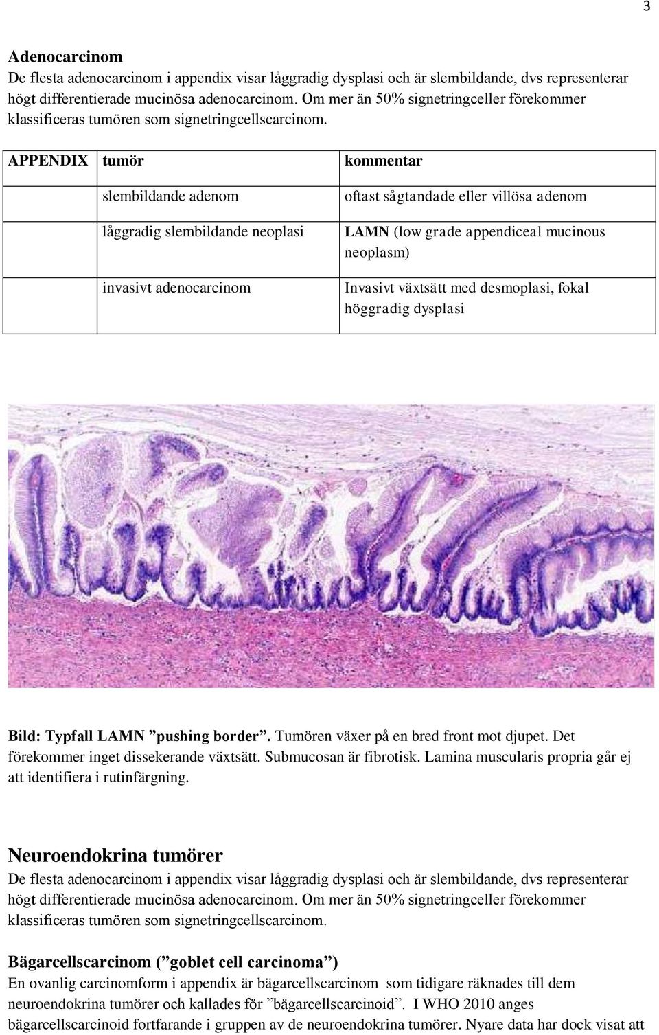 APPENDIX tumör slembildande adenom låggradig slembildande neoplasi invasivt adenocarcinom kommentar oftast sågtandade eller villösa adenom LAMN (low grade appendiceal mucinous neoplasm) Invasivt