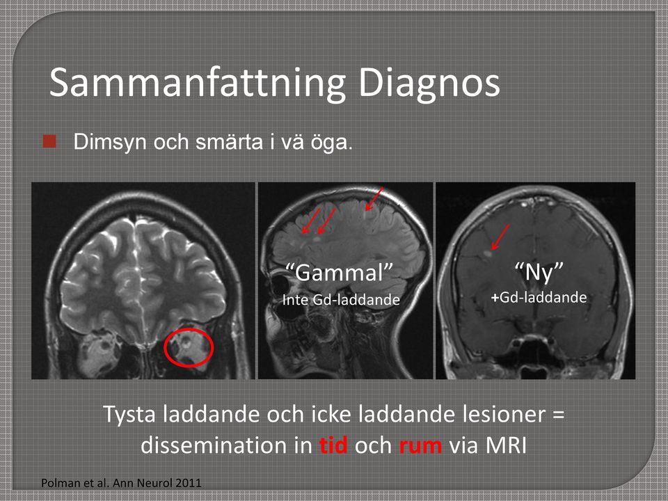 laddande och icke laddande lesioner =