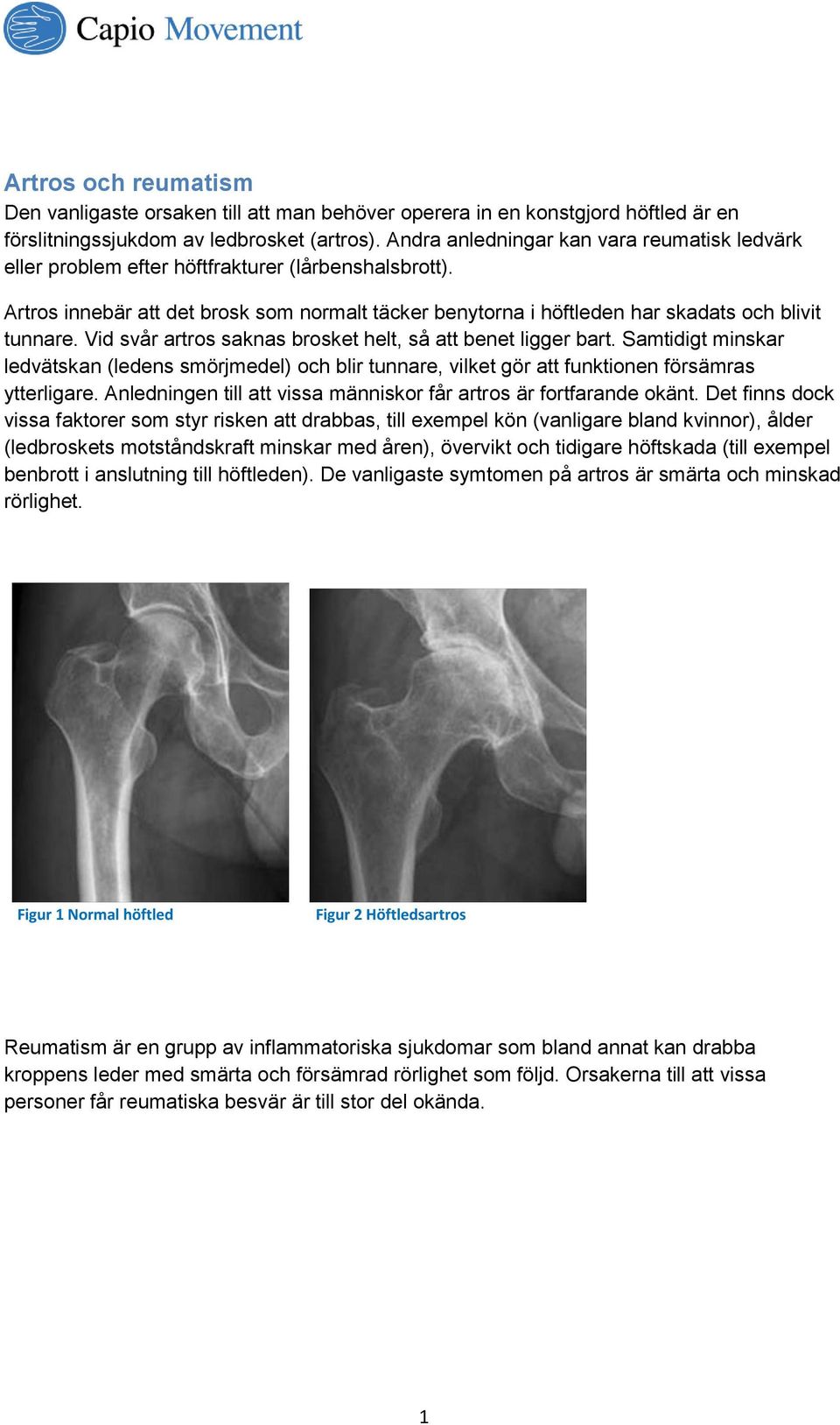 Vid svår artros saknas brosket helt, så att benet ligger bart. Samtidigt minskar ledvätskan (ledens smörjmedel) och blir tunnare, vilket gör att funktionen försämras ytterligare.