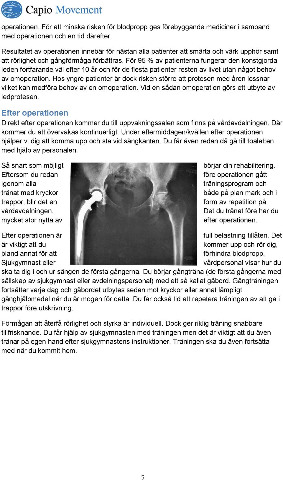 För 95 % av patienterna fungerar den konstgjorda leden fortfarande väl efter 10 år och för de flesta patienter resten av livet utan något behov av omoperation.