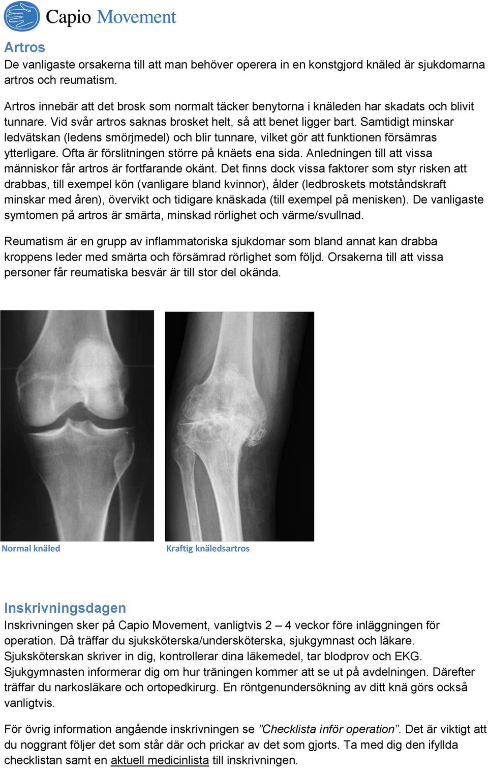 Samtidigt minskar ledvätskan (ledens smörjmedel) och blir tunnare, vilket gör att funktionen försämras ytterligare. Ofta är förslitningen större på knäets ena sida.