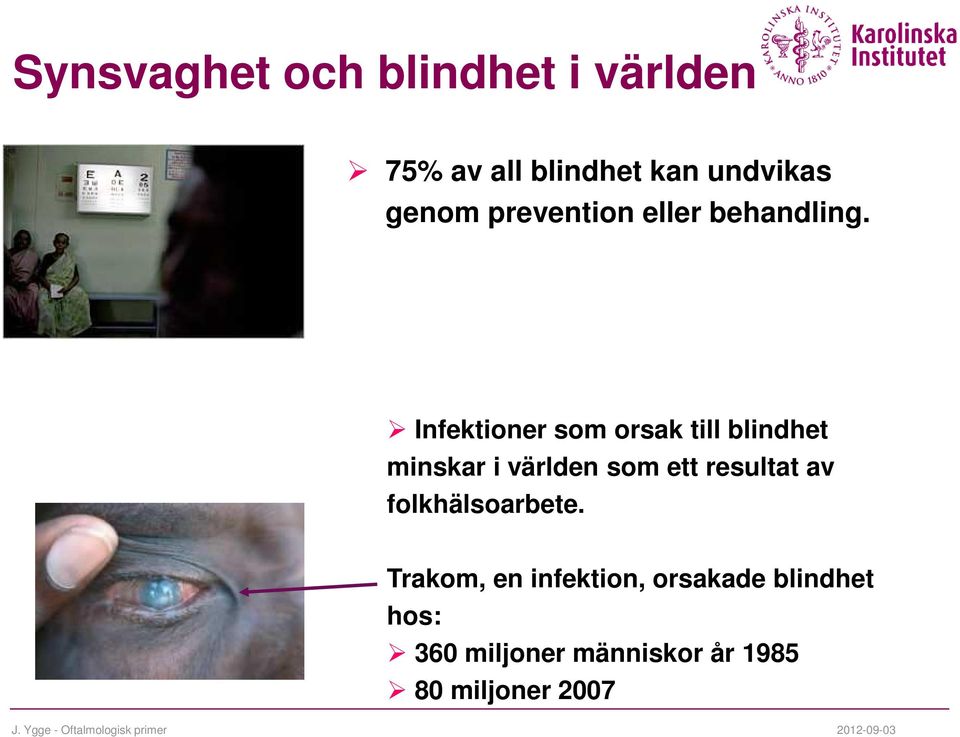 Infektioner som orsak till blindhet minskar i världen som ett resultat