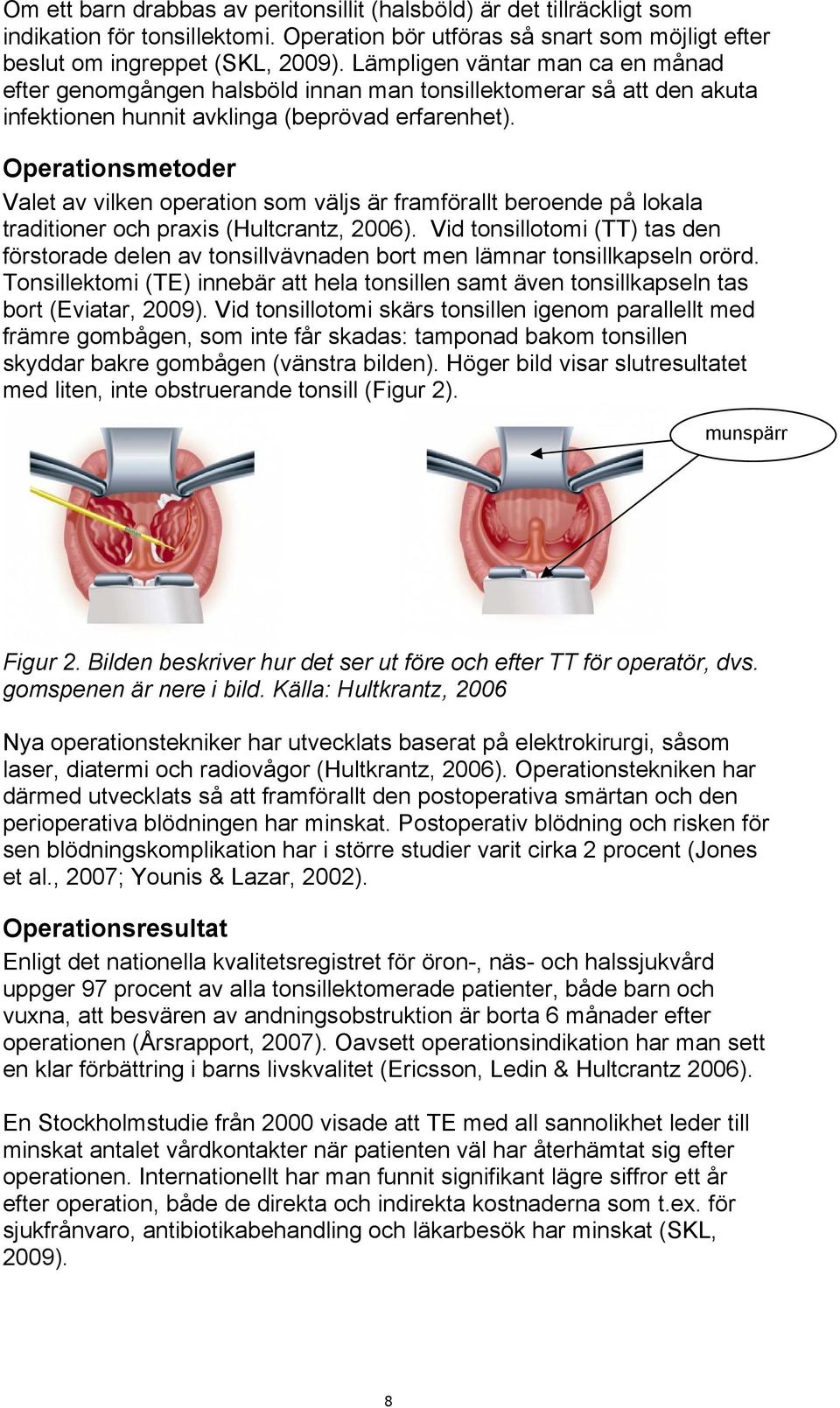 Operationsmetoder Valet av vilken operation som väljs är framförallt beroende på lokala traditioner och praxis (Hultcrantz, 2006).