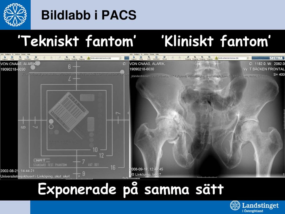 Kliniskt fantom