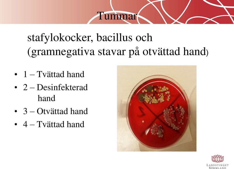 hand Tummar stafylokocker,