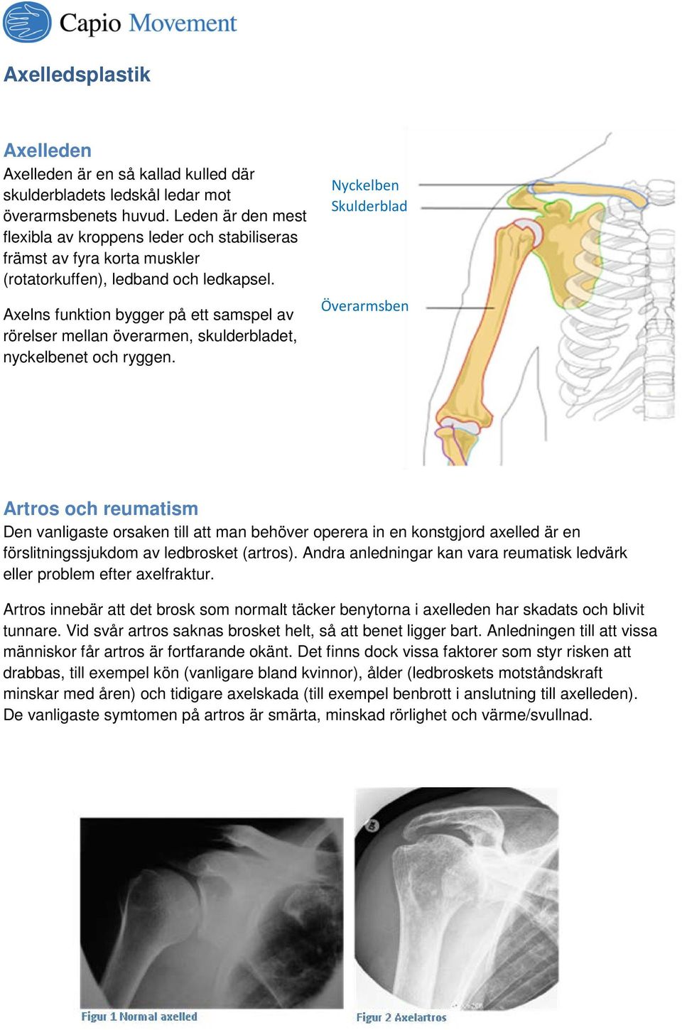Axelns funktion bygger på ett samspel av rörelser mellan överarmen, skulderbladet, nyckelbenet och ryggen.