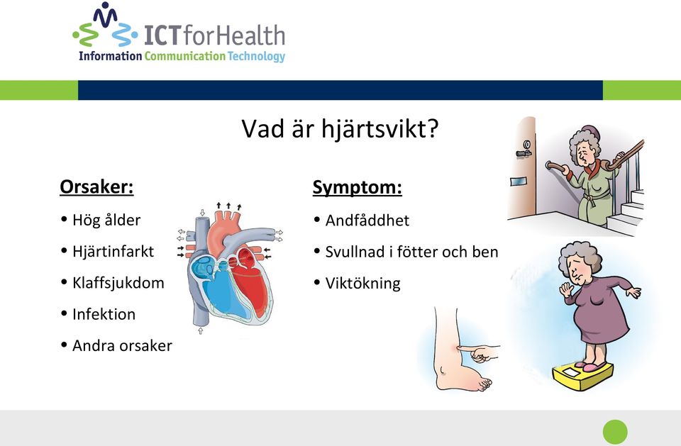 Andfåddhet Hjärtinfarkt Svullnad i