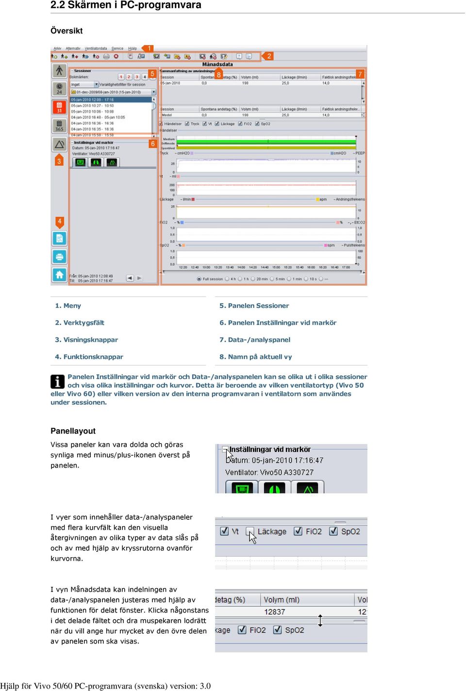 Detta är beroende av vilken ventilatortyp (Vivo 50 eller Vivo 60) eller vilken version av den interna programvaran i ventilatorn som användes under sessionen.