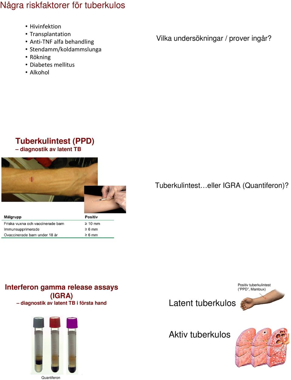 Tuberkulintest (PPD) diagnostik av latent Tuberkulintest eller IGRA (Quantiferon)?