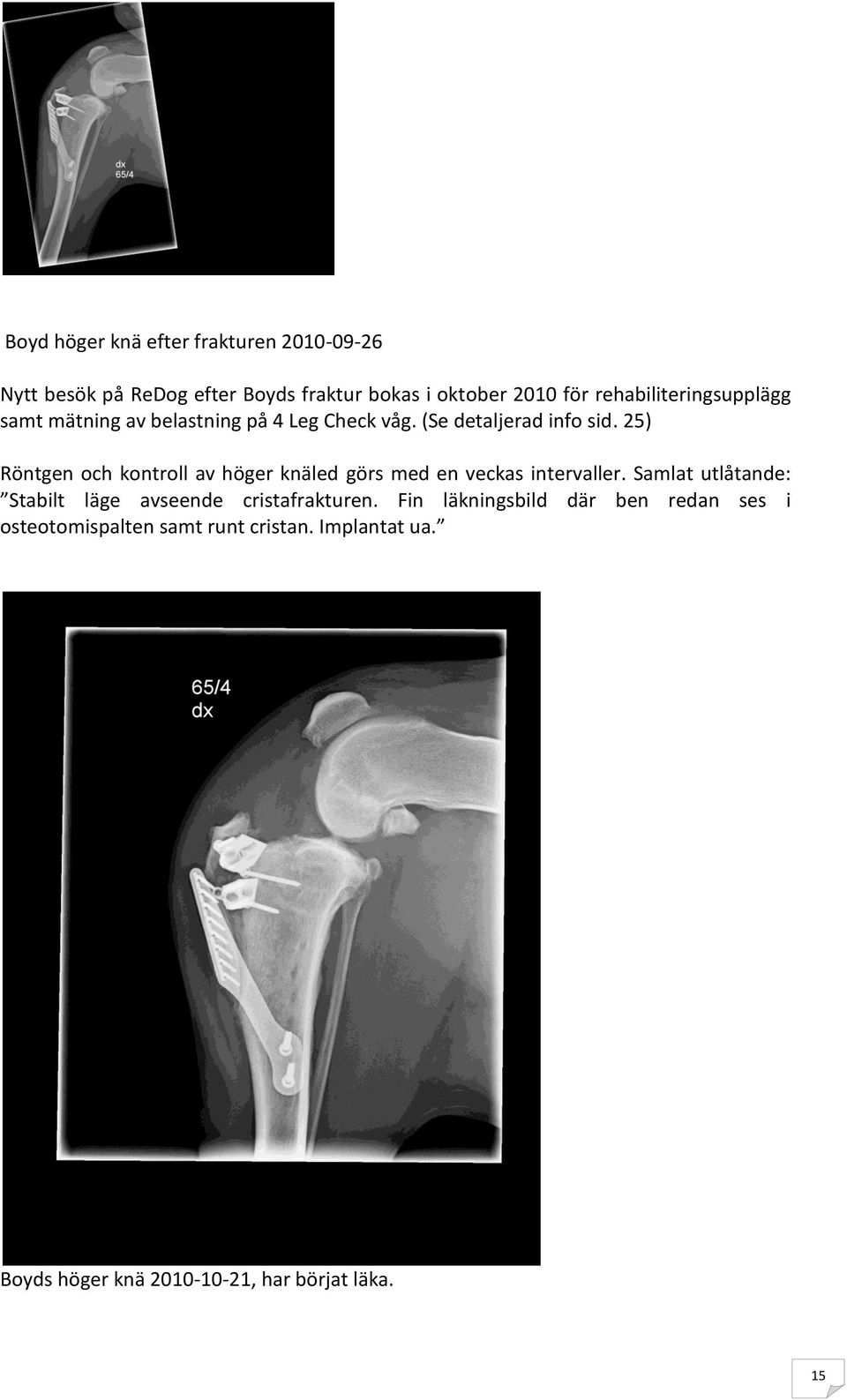 25) Röntgen och kontroll av höger knäled görs med en veckas intervaller.