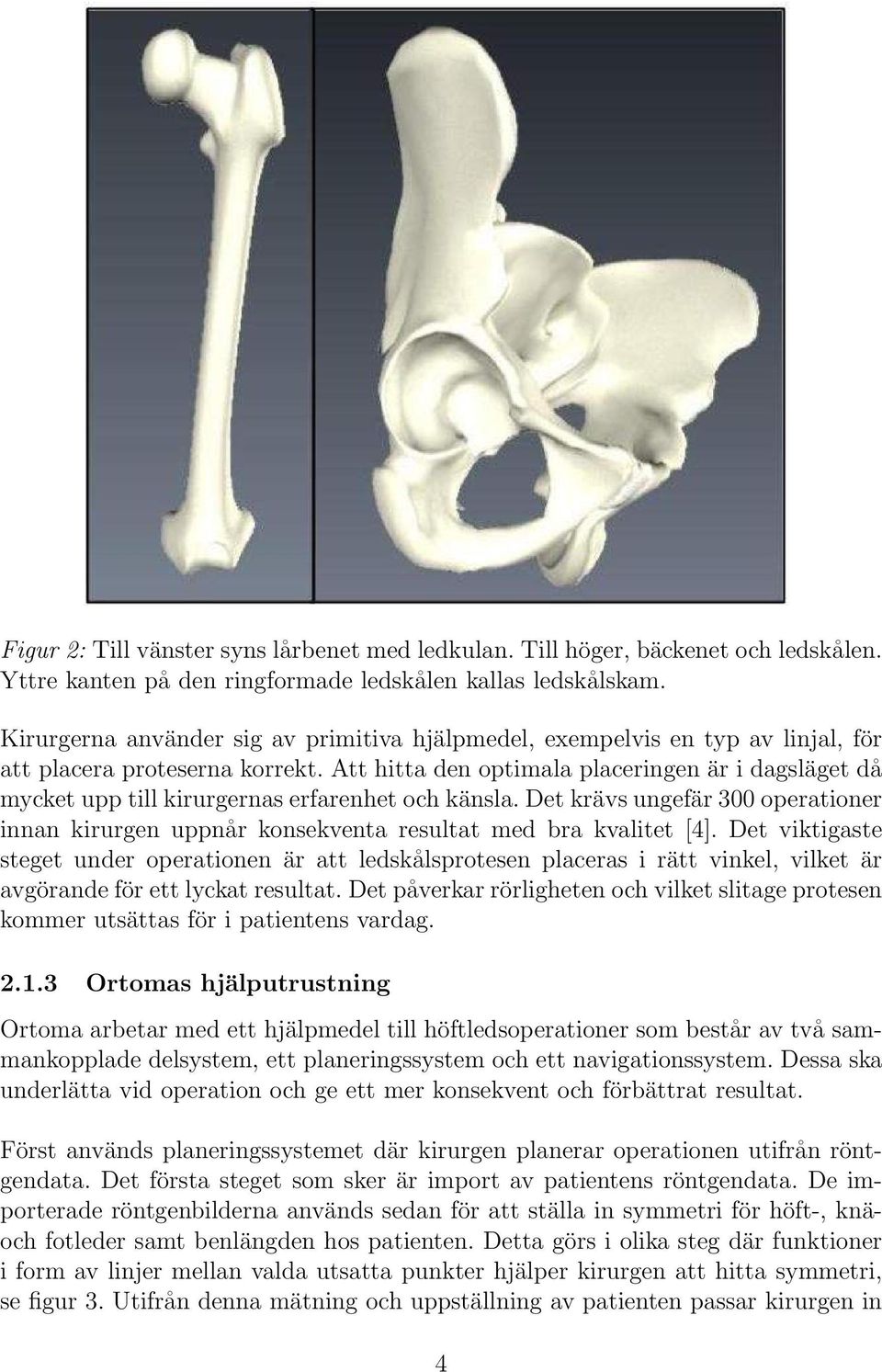 Att hitta den optimala placeringen är i dagsläget då mycket upp till kirurgernas erfarenhet och känsla.