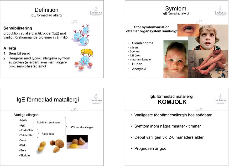 Reagerar med typiskt allergiska symtom av protein (allergen) som man tidigare blivit sensibiliserad emot Huden Anafylaxi IgE förmedlad matallergi Ägg Spädbarn små barn 90% av alla