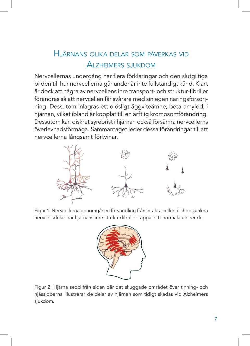 Dessutom inlagras ett olösligt äggviteämne, beta-amylod, i hjärnan, vilket ibland är kopplat till en ärftlig kromosomförändring.