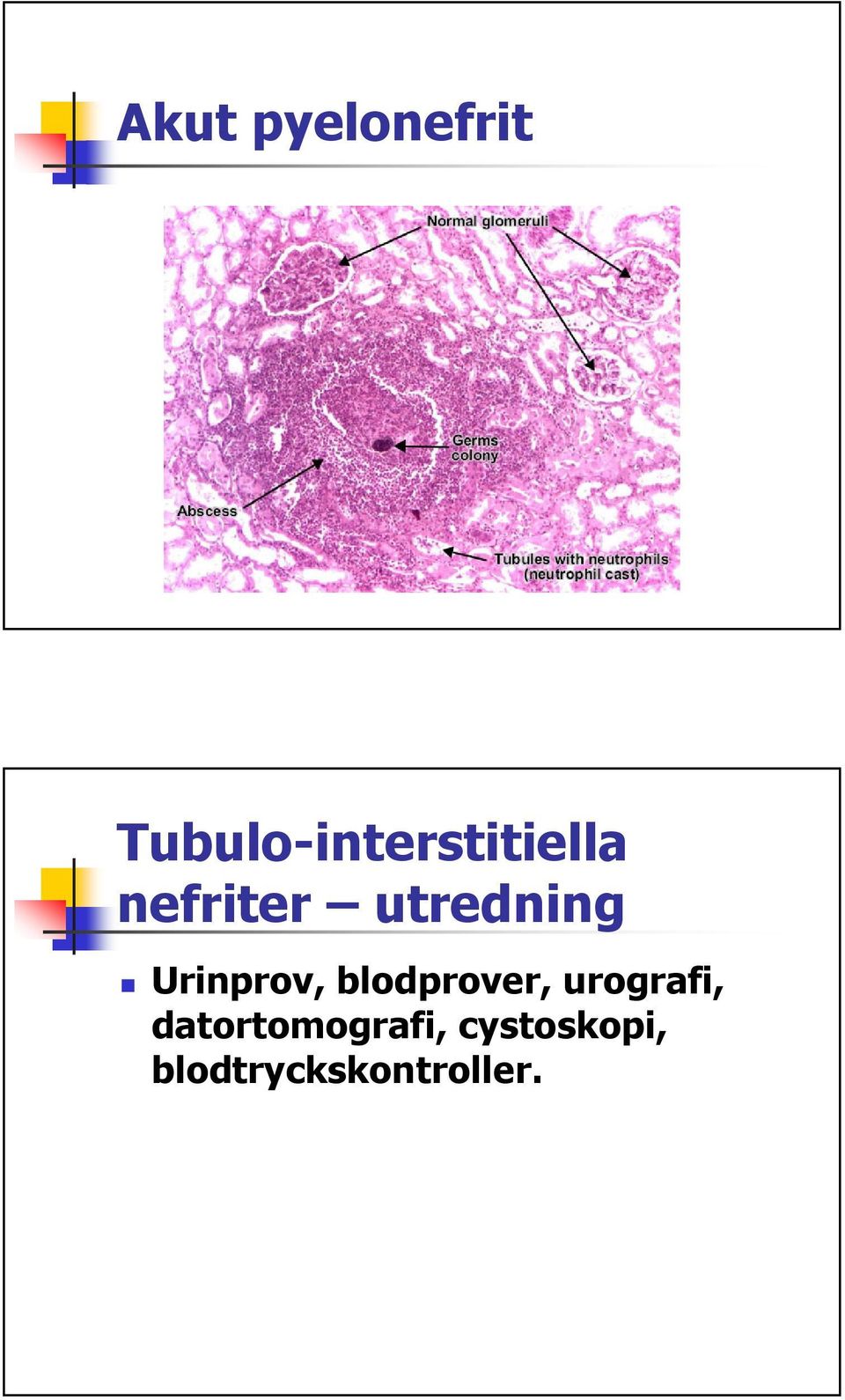 utredning Urinprov, blodprover,