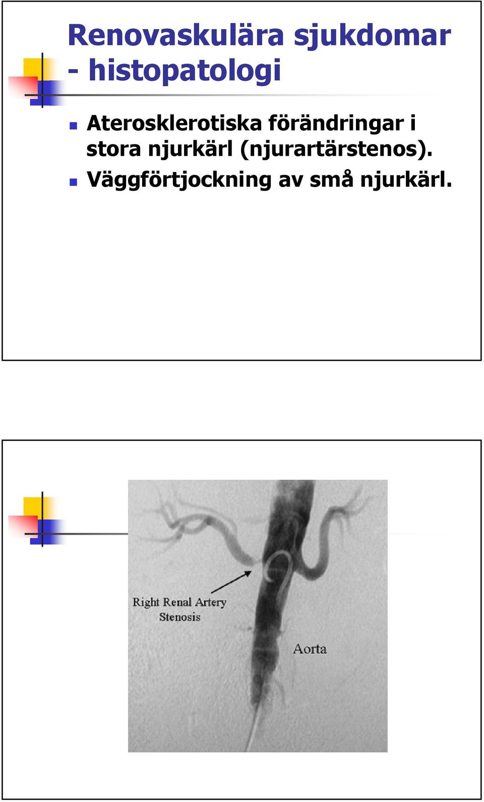 förändringar i stora njurkärl