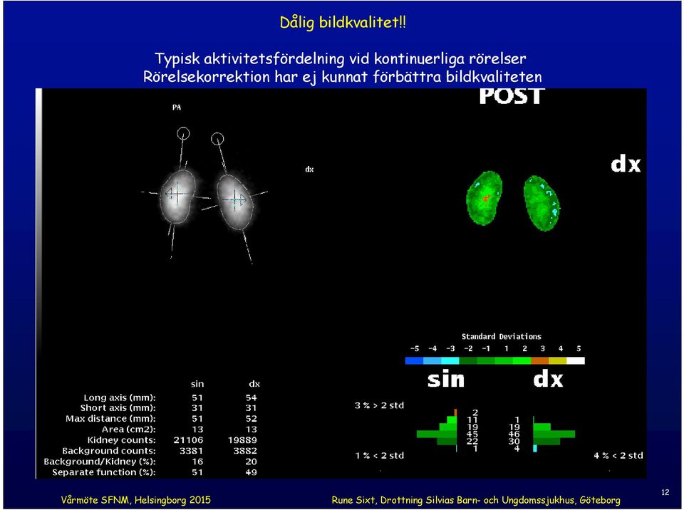 kontinuerliga rörelser