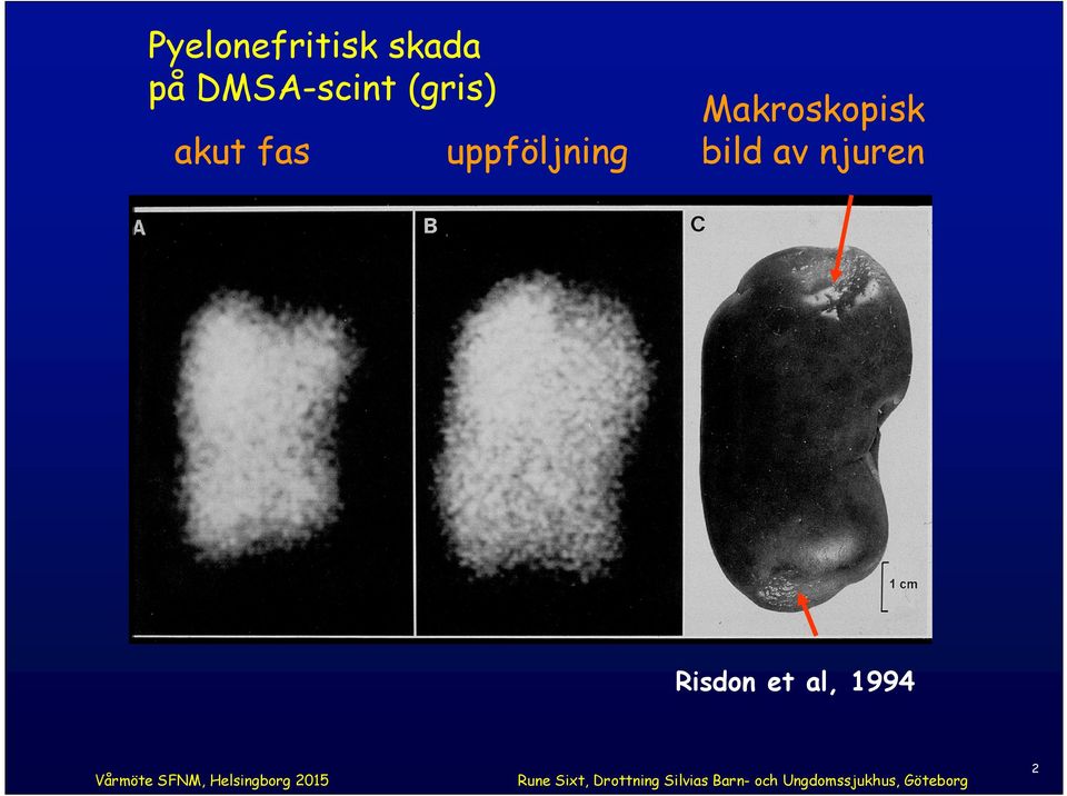 uppföljning Makroskopisk