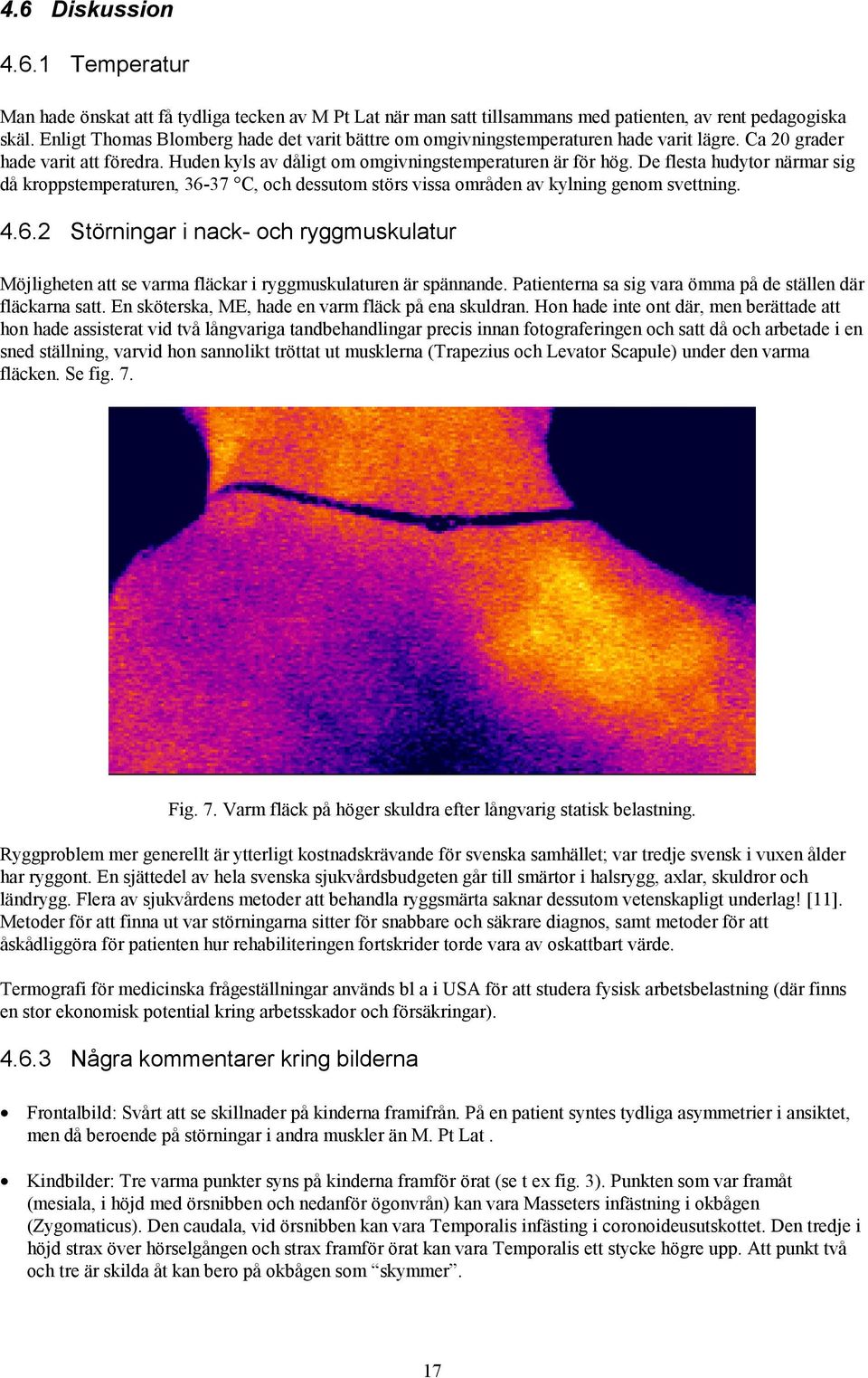 De flesta hudytor närmar sig då kroppstemperaturen, 36-37 C, och dessutom störs vissa områden av kylning genom svettning. 4.6.2 Störningar i nack- och ryggmuskulatur Möjligheten att se varma fläckar i ryggmuskulaturen är spännande.