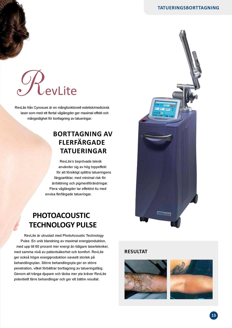 pigmentförändringar. Flera våglängder tar effektivt itu med envisa flerfärgade tatueringar. PhotoAcoustic Technology Pulse RevLite är utrustad med PhotoAcoustic Technology Pulse.