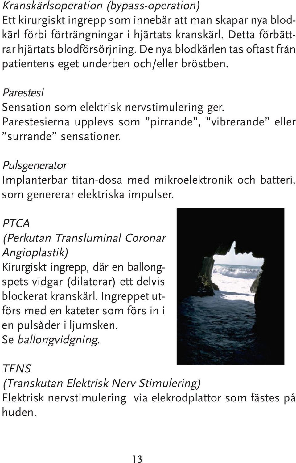 Parestesierna upplevs som pirrande, vibrerande eller surrande sensationer. Pulsgenerator Implanterbar titan-dosa med mikroelektronik och batteri, som genererar elektriska impulser.