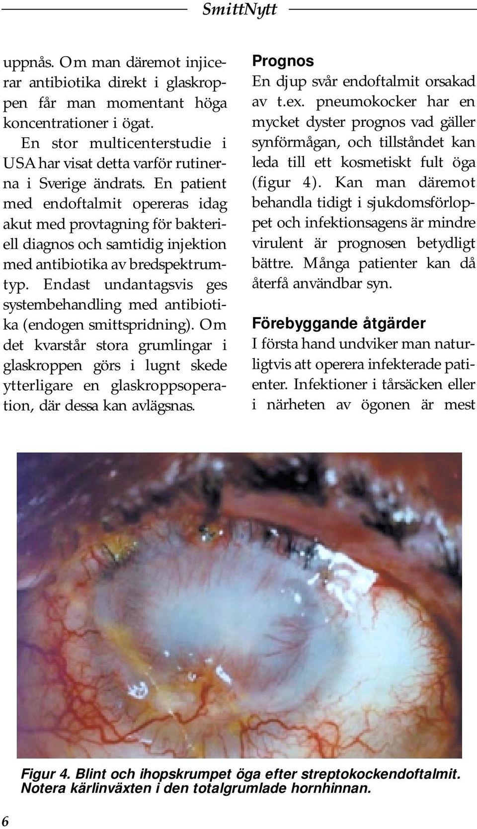 Endast undantagsvis ges systembehandling med antibiotika (endogen smittspridning).