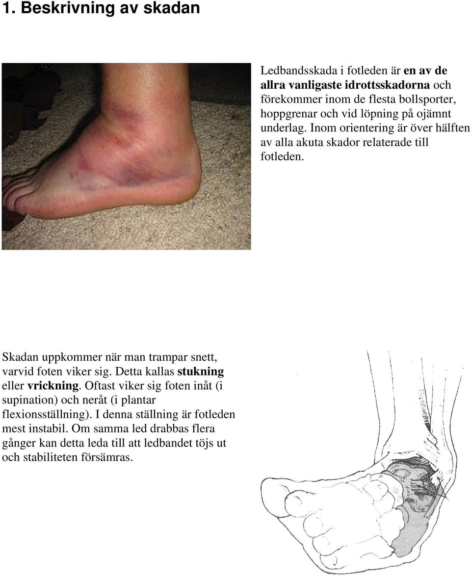 Skadan uppkommer när man trampar snett, varvid foten viker sig. Detta kallas stukning eller vrickning.