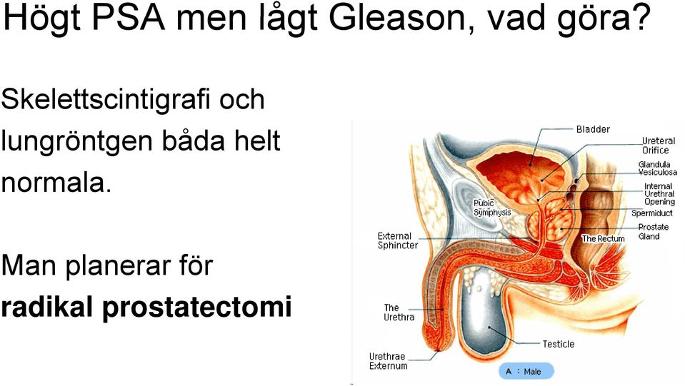 lungröntgen g båda helt normala.