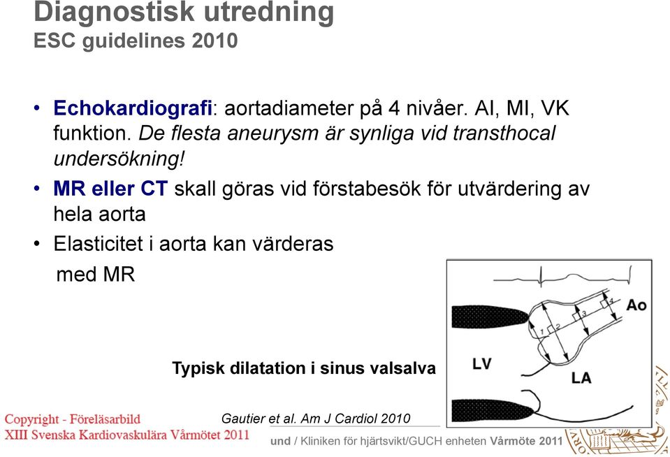 MR eller CT skall göras vid förstabesök för utvärdering av hela aorta Elasticitet i