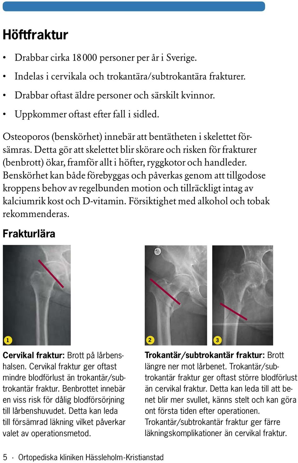 Detta gör att skelettet blir skörare och risken för frakturer (benbrott) ökar, framför allt i höfter, ryggkotor och handleder.