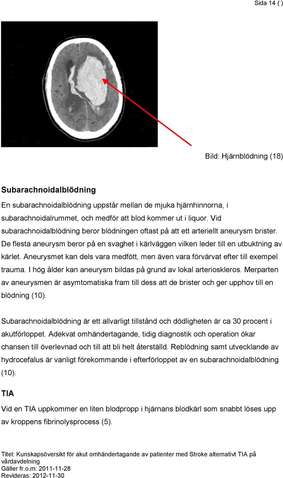 Aneurysmet kan dels vara medfött, men även vara förvärvat efter till exempel trauma. I hög ålder kan aneurysm bildas på grund av lokal arterioskleros.