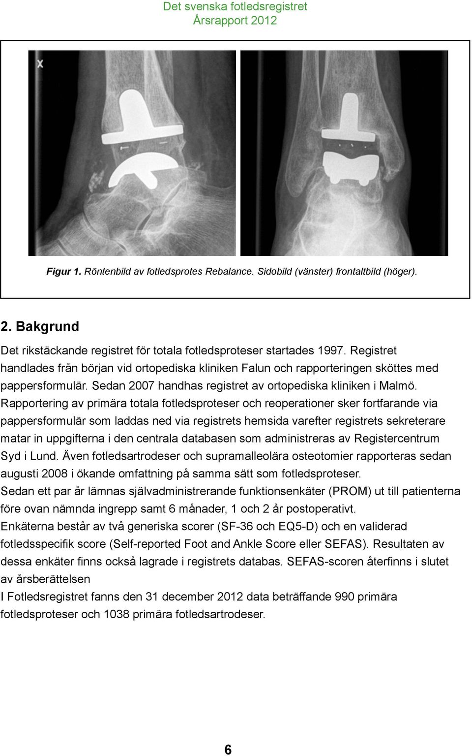 Rapportering av primära totala fotledsproteser och reoperationer sker fortfarande via pappersformulär som laddas ned via registrets hemsida varefter registrets sekreterare matar in uppgifterna i den