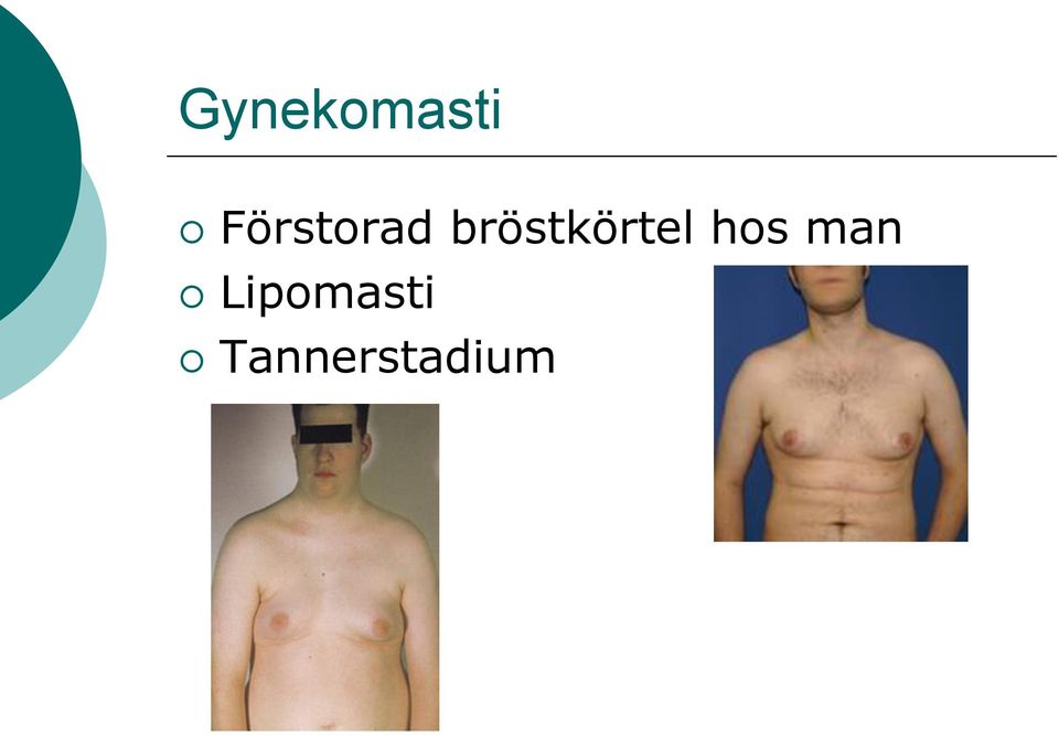 bröstkörtel hos