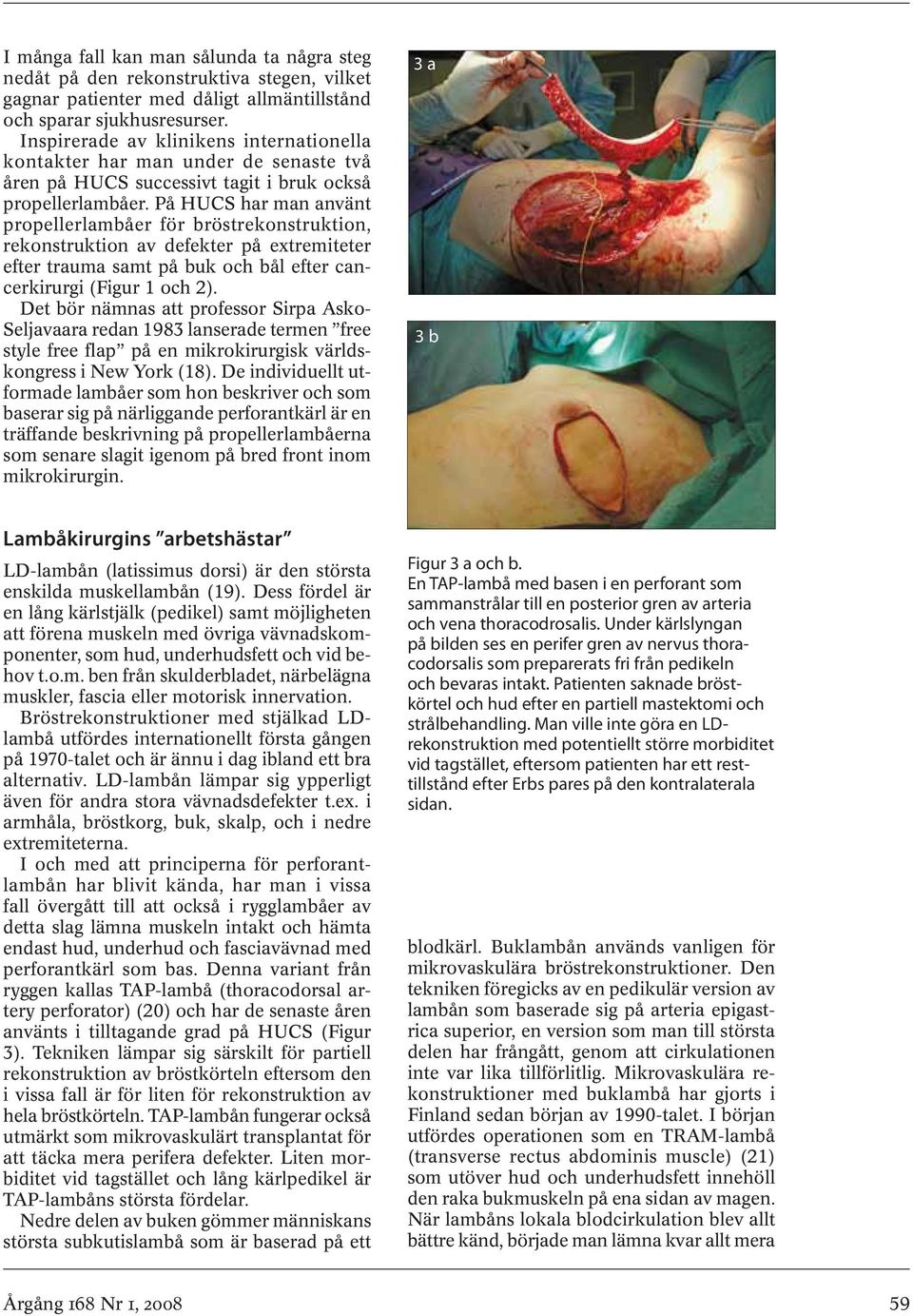 På HUCS har man använt propellerlambåer för bröstrekonstruktion, rekonstruktion av defekter på extremiteter efter trauma samt på buk och bål efter cancerkirurgi (Figur 1 och 2).