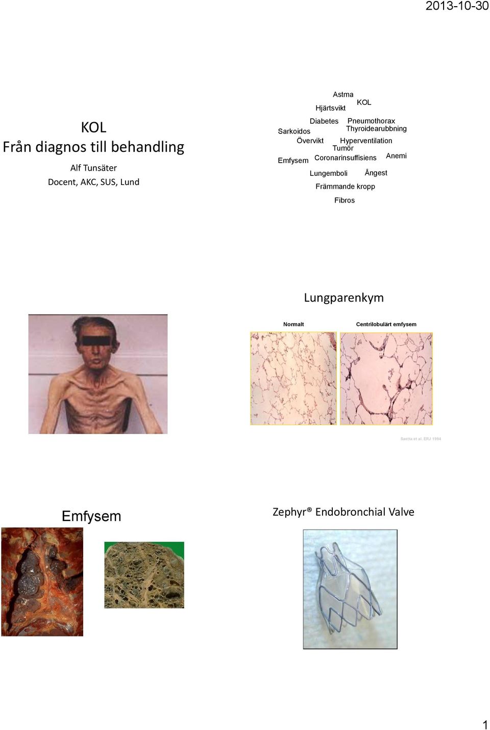 Emfysem Coronarinsuffisiens Anemi Lungemboli Ångest Främmande kropp Fibros