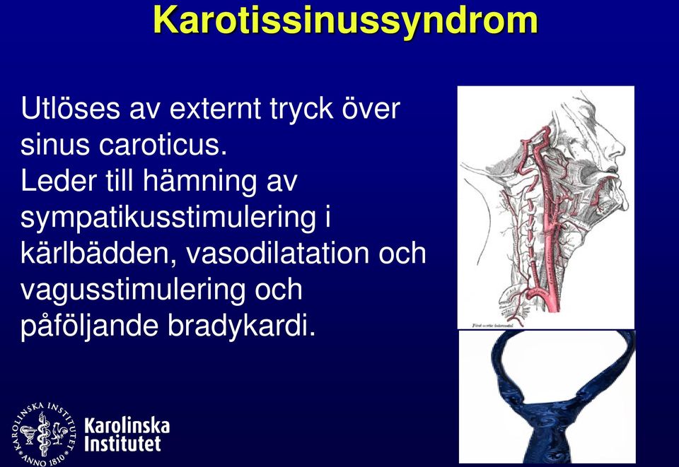 Leder till hämning av sympatikusstimulering i